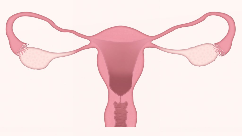 hysterectomy: cervix