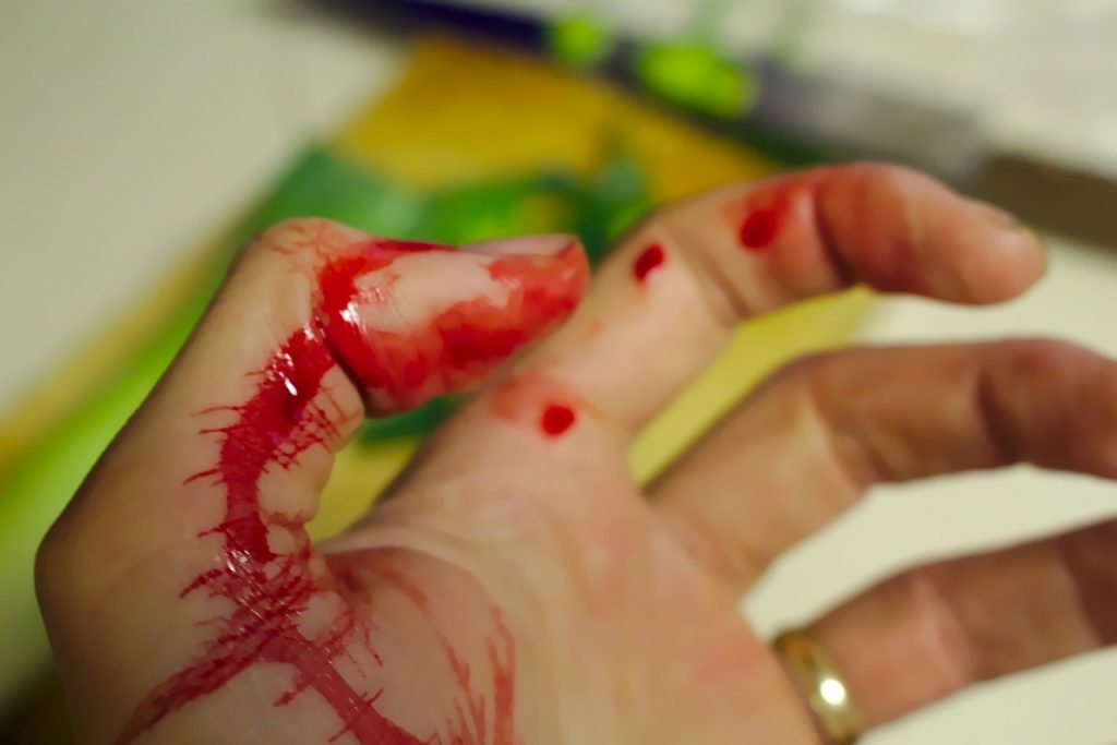 bleeding Minor Cuts